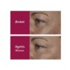 CENTIFOLIA Lys Active® Silma- ja huulekontuuri kreem, 15ml – pilt 3